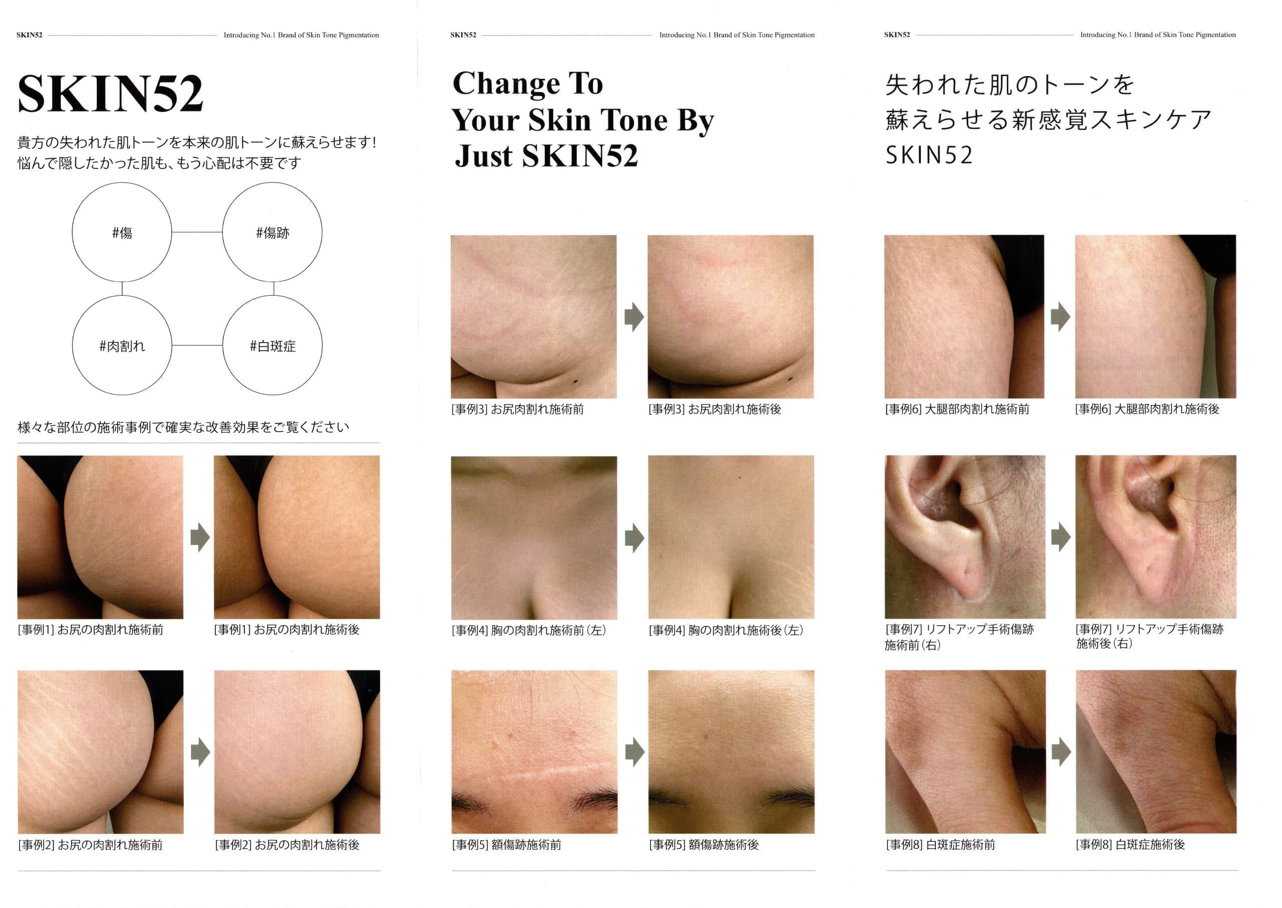 skin52-1.jpg